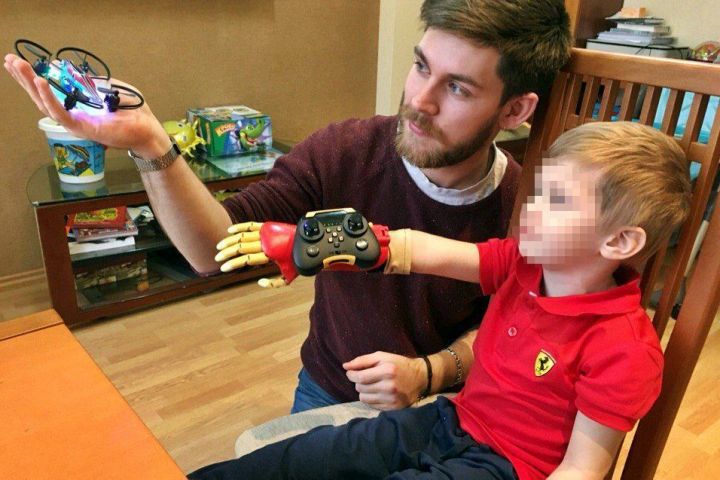 Челнинский инженер-протезист помогает детям без конечностей почувствовать себя «супергероями»